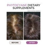 PHYTOCYANE Anti-Hair Thinning Dietary Supplement 84 caps (12-Week Supply)