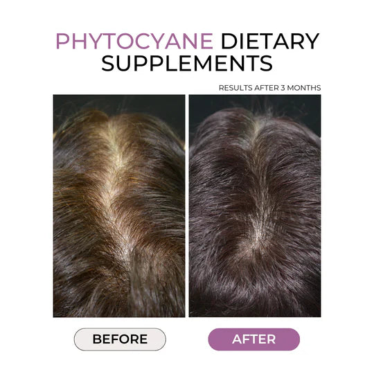 PHYTOCYANE Anti-Hair Thinning Dietary Supplement 84 caps (12-Week Supply)