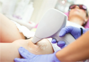 Care for Laser Hair Removal
