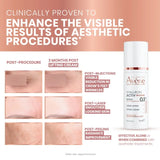 Avène Hyaluron Activ B3 Procedure Creme Lifting  30ml